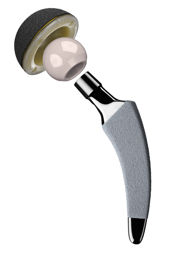 Total hip endoprosthesis consisting of stem, head and cup