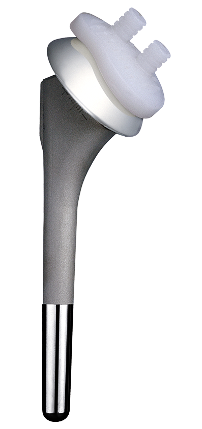 Example of a total endoprosthesis consisting of stem, head and glenoid 